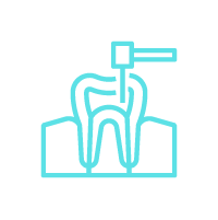 Endodoncia